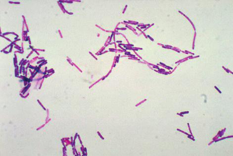 , Escherichia coli O157, koagülaz pozitif stafilokoklar, Bacillus cereus ve sülfit indirgeyen anaerob bakteri olmak üzere yedi başlıkta toplanmaktadır.