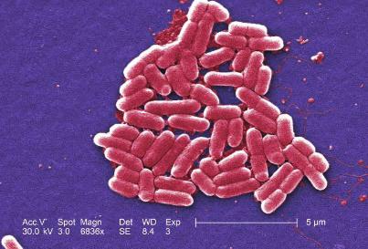 Campylobacter Campylobacter türleri içerisinde termotolerant olanlar insanlarda patojen olarak kabul edilirler. Termotolerant türler içinde, Campylobacter jejuni, C. upsaliensis, C. lari ve C.