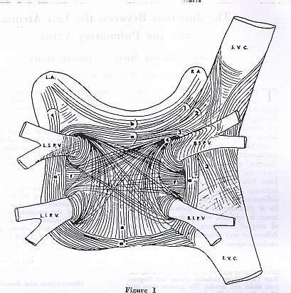 Pulmoner ven izolasyonu