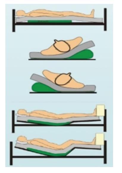 POZİSYONLU HAVALI YATAK SİSTEMİ (SNS 8000 T ) : Yatak içerisinde pozisyon alma güçlüğü çeken veya bundan sonraki yaşam kalitesini yatak içerisinde geçirecek kısmi yatağa bağımlı hastalar için dizayn