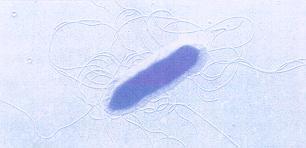 10 Şekil 2.2. Erwinia amylovora bakterisi (Van Der Zwet ve Beer, 1991). Yapılan bir araştırmada, E. amylovora ile bulaşık dallardan kesilerek alınan parçacıklar, sterilize edilmiştir.