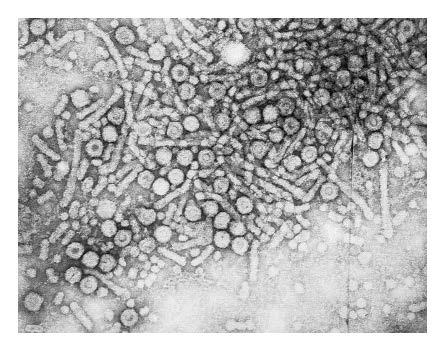 karsinojenlerden birisi HCV den 10,