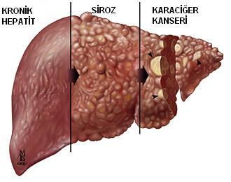 KRONİK