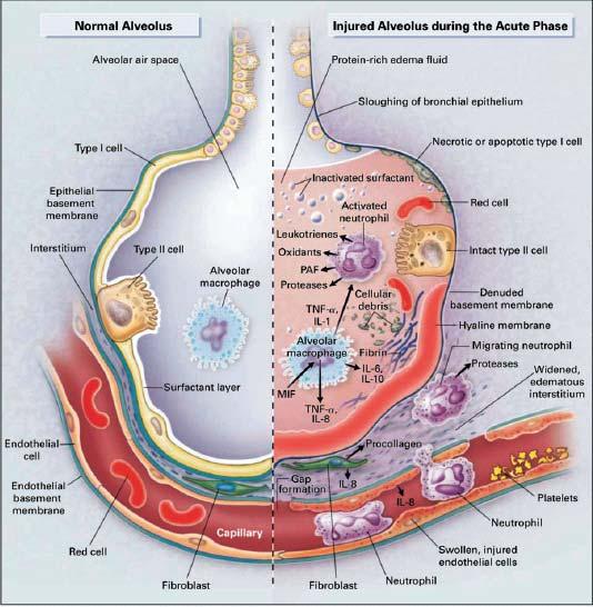 NEJM 2000