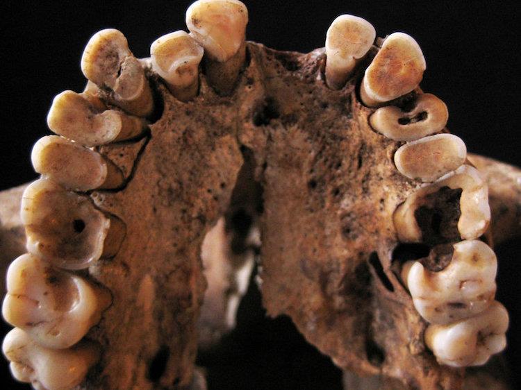 Paleolitik dönemde yaşamış insanların dişleri, modern insanınkilerden daha sağlıklıydı.