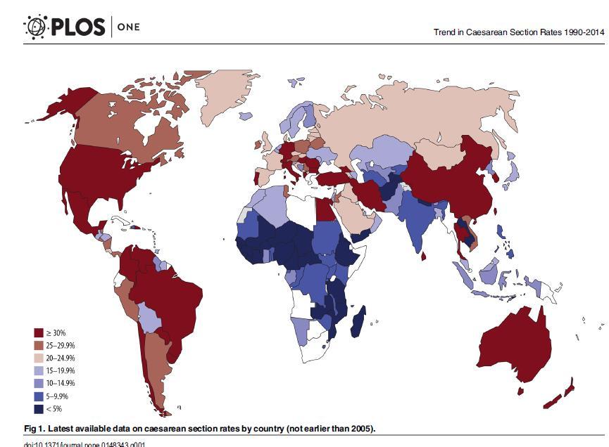 Dünyada Sezaryen Oranı