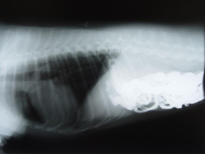 Organizmada ekstremite gibi kemik ihtiva eden kısımlar, radyografik olarak kolayca görüntülenebildiği halde (düz radyografi), abdominal boşlukta bulunan ve benzer yoğunluktaki yumuşak dokulardan