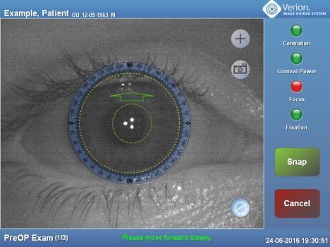 4. Adım Cihazı hastanın gözüne hizalayın ve odaklayın. Odaklama yardımcısı (oklar), durum ışıkları (sağda) ve kılavuz mesaj (ekranın alt kısmında) bu prosedüre destek verir.