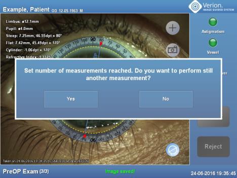 8. Adım Maksimum ölçüm sayısına ulaşıldığında Set number of measurements reached. Do you want to perform still another measurement? (Ayarlanan ölçüm sayısına ulaşıldı.