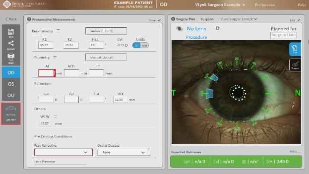 Measurement Mode (Ölçüm Modu) etkinleşir. PreOp Referans Ölçümünün 3. ve 9. adımlarını yukarıda anlatıldığı şekilde tekrarlayın. Referans Ölçümler (Axis Only Yalnızca Aks) 1.