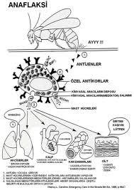 4) Anafilaktik Şok Şiddetli antikor-antijen birleşmesi esasına dayanır.