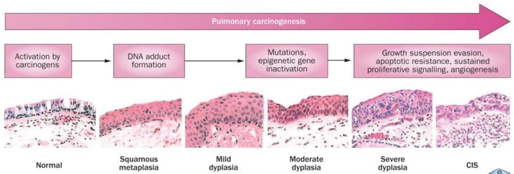 Lung Carcinogenesis
