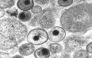 İnfekte hücrenin elektron mikroskopik görüntüsü