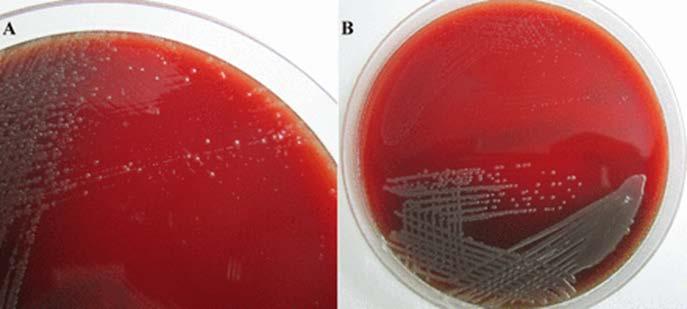 O.rhinotracheale nin optimal üremesi 37 C