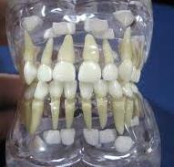 Süt Dişleri Bebek dişleri de denir. Toplam 20 adettir ve bebekler ortalama 6 aylık olduklarında çıkmaya başlarlar.
