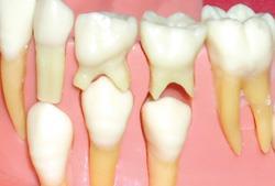 Süt Dişlerinin Fonksiyonları Sürekli dişler için yer tutarak doğru yerde ve düzgün olarak çıkmalarını sağlarlar.