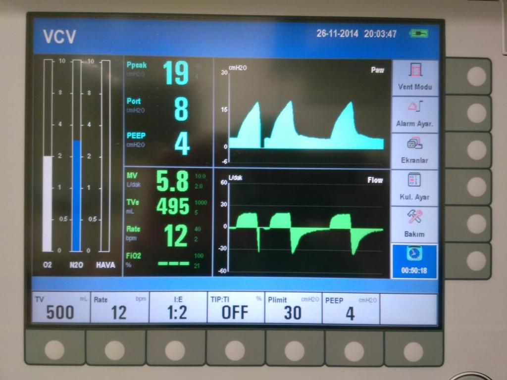 Tek Slaytta Tüm Ventilatör Değerleri VT: Tidal volüm = Hastaya her bir solukta verilen hava hacmidir. F: Frekans = Solunum sayısı = Hastaya 1 dakika boyunca kaç kez nefes aldıracağımızdır.
