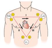 Kalbin Ritmi Sinüs ritm neden normal ritm olarak değerlendirilir? Elektriksel aktivitenin, bahsedildiği gibi sinoatriyal noddan başlaması doğalfizyolojik olanıdır.