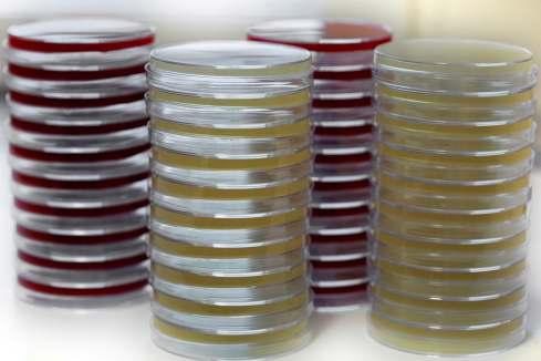 FasHdious Agar (MH