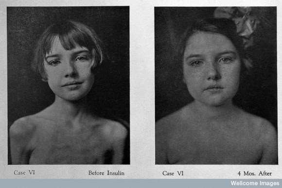 et al: J Metabolic Res 2: 767-792, 1922;