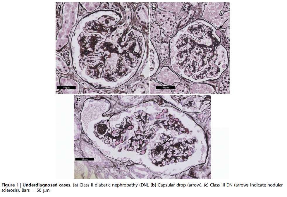 Klessens et al: