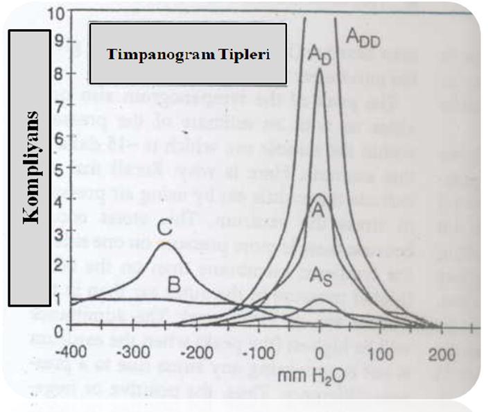 Tip A : +50 ile -50 dapa basınç aralığında pik yapan, amplitüdünün normal sınırlarda (ortalama 0.6 ml) olduğu timpanogram eğrisidir. Sıklıkla normal orta kulaklarda elde edilen timpanogram tipidir.