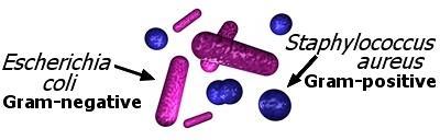 Manyetit ve TiO 2 kompoziti ile gram negatif E. coli nin ve gram pozitif S. aureus un giderimlerinin tamamen farklı mekanizmalarla olduğu ortaya konulmuştur. E. coli nin inaktivasyonu dış zaraların ve hücre duvarlarının parçalanmasıyla gerçekleşirken S.