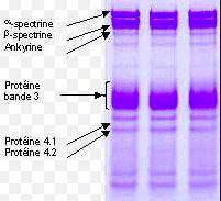 SDS PAGE Electrophoresis Hangi