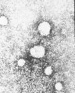 Hepatit C Enfeksiyonu: Tedavi Hepatit C Enfeksiyonu: Önlenmesi Interferon Ribavirin Telepravir Bocepravir Diğerleri Kan, organ ve doku vericilerinin taranması, pozitif saptanan bireylere olan