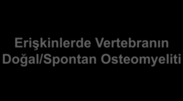 Erişkinlerde Vertebranın Doğal/Spontan Osteomyeliti Prof. Dr.