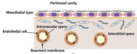 Peritoneal Membran İnterstisyum; ekstraselüler matriks, kollajen, mukopolisakkarid demetleri, fibroblastlar, mononükleer hücreler ve sinir