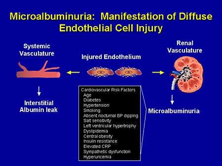 Albuminüri yaygın endotel hasarının göstergesidir Sistemik Dolaşım Hasarlı Endotel Renal Damar Yatağı Interstisyel Albumin Kaçağı Kardiyo-Renal Risk Faktörleri Yaş