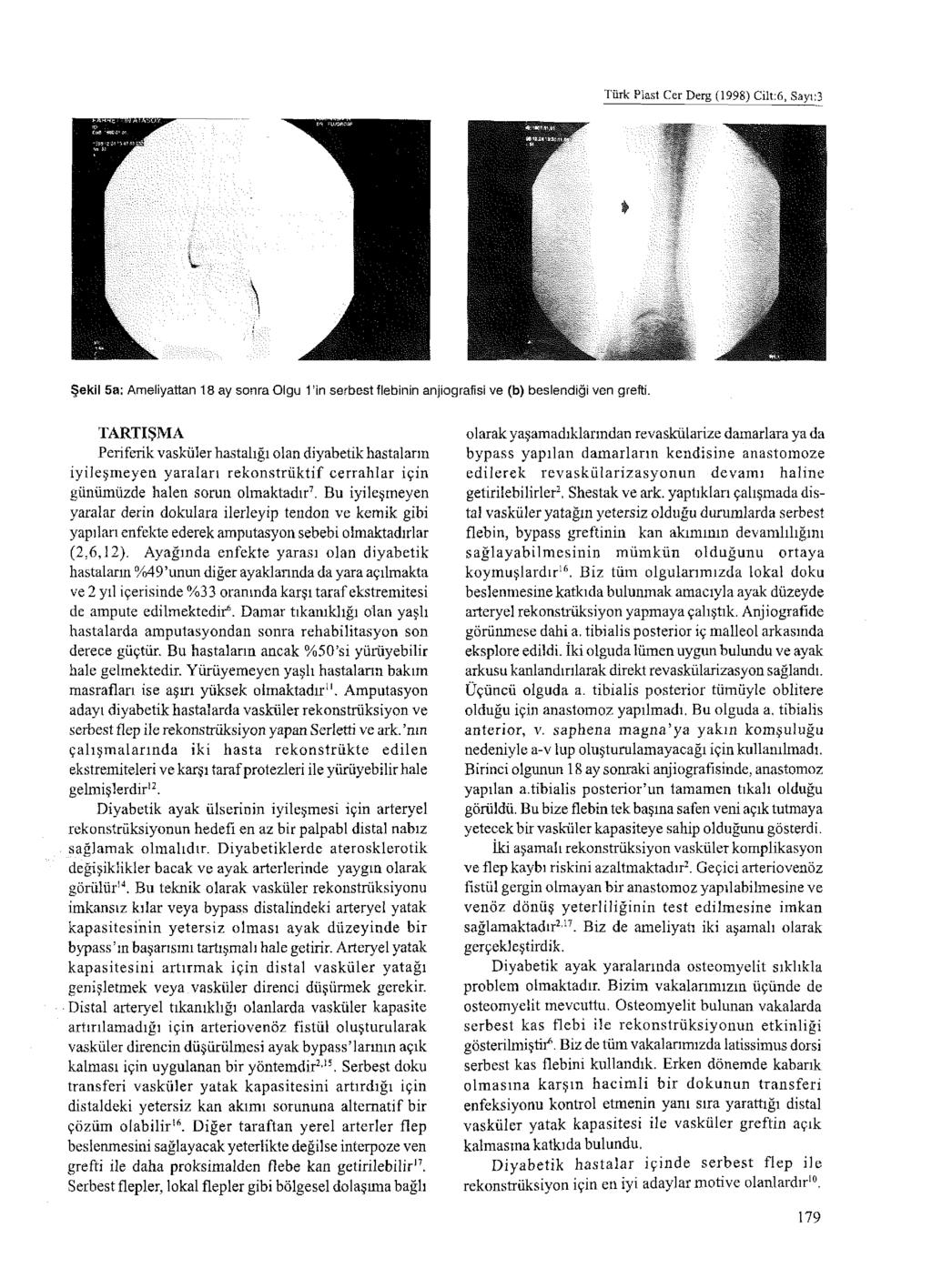 Türk Plast Cer Derg (1998) Cilt:6, Sayı:3 Şekil 5a: Ameliyattan 18 ay sonra Olgu 1 in serbest flebinin anjiografisi ve (b) beslendiği ven grefti.