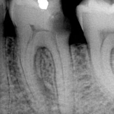 Bu sayede materyal esnekliği ve rejenerasyonu açısından çok benzer özellikler elde edilmektedir.