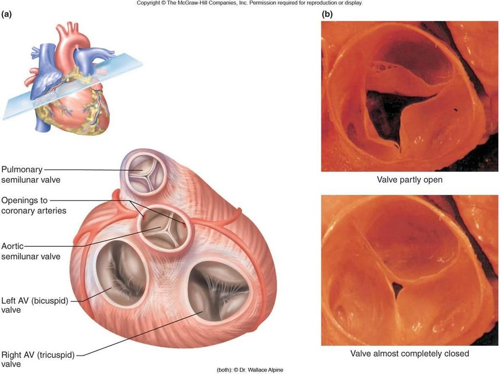 Kalbin Kapakları Akciğer yarımay kapakçığı Kapakçık az açılmış Aort yarımay kapakçığı Sol atrioventriküler