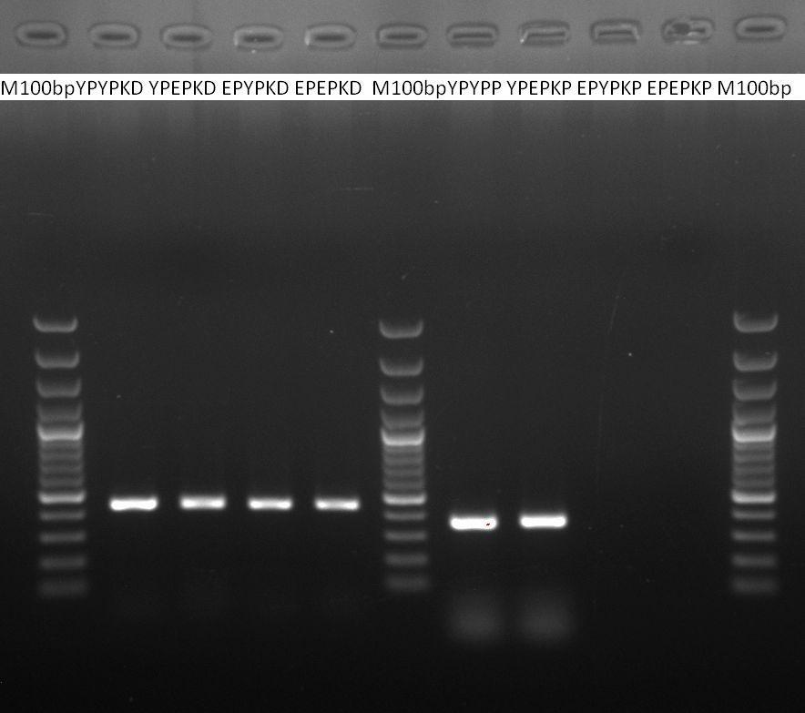 51 3. BULGULAR 3.1. PCR Sonuçları Gereç ve yöntemde belirtildiği şekilde önce plazma örneklerinden (n:211) elde edilen lökosit tabakasından elde edilen RNA kalıp olarak kullanılmak suretiyle cdna