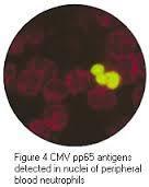 Antijenemi testi Lökositlerde pp65 matriks proteinin erken dönemde Duyarlılık kültürden yüksek Antijen