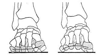Ayağın gelişimi üç aşamada incelenmektedir. 1. Bebeklik Kemikler yumuşak ve esnektir. Ayak şekli üçgen biçiminde, topuk dar, parmak kısmında geniştir.