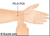 Pc 6 akupunktur noktası, her iki kolun iç tarafında, bilek çizginizden iki
