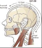 Alın saç çizgisinin orta noktasında, dış oksipital tümsekte, kulak tepe