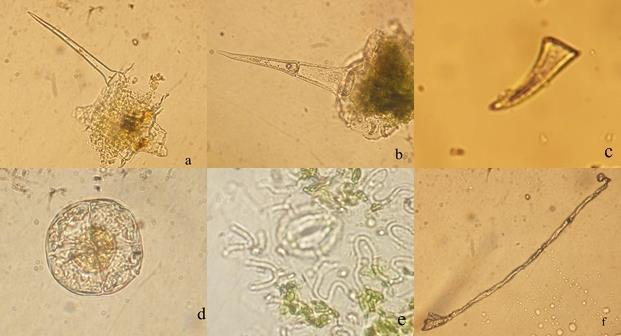 117 Şekil 4-3: M1 örneğinin mikroskobik incelemesi (a, b: örtü tüyü; c: diş şeklinde örtü tüyü; d: salgı tüyü; e: diasitik stoma; f: yabancı yapı) M2 örneğinin makroskobisinde çok fazla sayıda dal