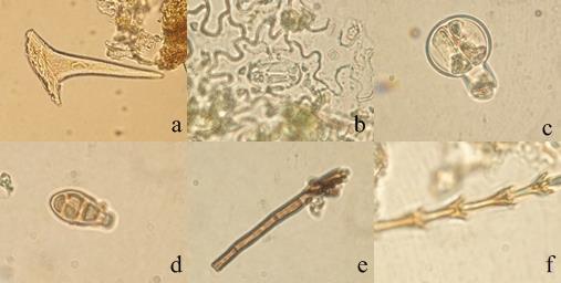 120 Şekil 4-7: M3 örneğinin mikroskobik incelemesi (a: diş şeklinde örtü tüyü; b: stoma; c, d: salgı tüyü; e, f: yabancı yapılar)