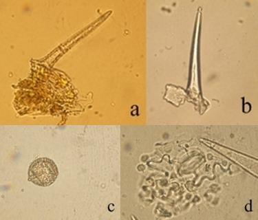 121 Şekil 4-9: M4 örneğinin mikroskobik incelemesi (a, b: örtü tüyü; c: polen; d: 3 komşu hücreli stoma hücresi) M5 drogu eczaneden alınan drog örneğidir.