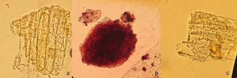 127 Şekil 4-18: H3 örneğinin mikroskobik incelemesi (a: epidermis; b: salgı hücresi; c: diasitik stoma) H4 örneğinin