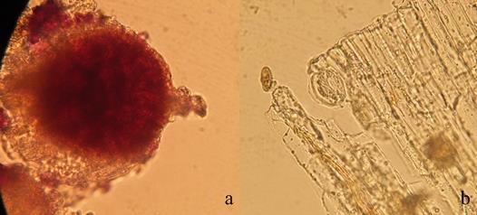 128 Şekil 4-20: H4 örneğinin mikroskobik incelemesi (a: salgı hücresi; b: epiderma ve stoma) H5 örneği eczaneden alınmış örnektir. Diğer örneklere göre oldukça iyi durumdadır.