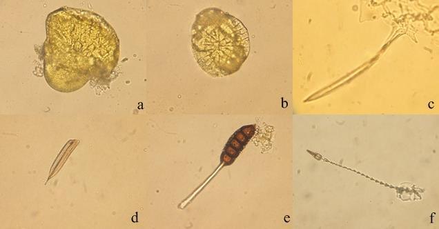 c: küflenmiş yaprak) Şekil 4-27: HL2 örneğinin mikroskobik