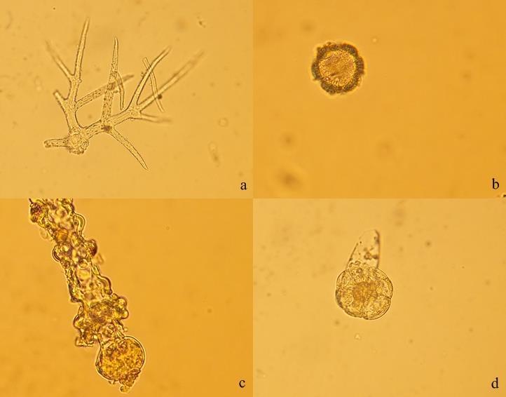 153 Şekil 4-54: L4 örneğinin mikroskobik incelemesi (a: örtü tüyü; b: polen; c: salgı tüyü; d: lamiaceae tipi salgı tüyü) L5 örneği eczane örneğidir.