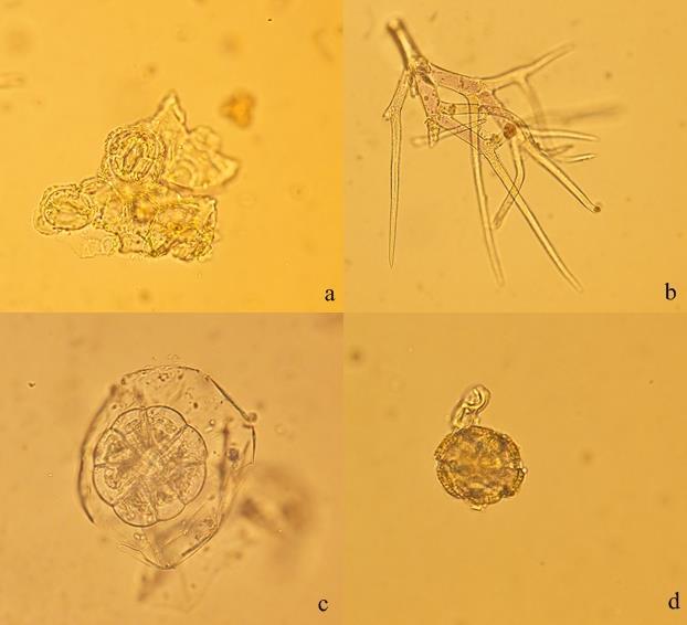 Şekil 4-56: L5 örneğinin mikroskobik incelemesi
