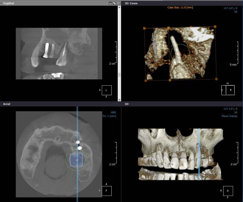 1. Computed Tomography 1-5.