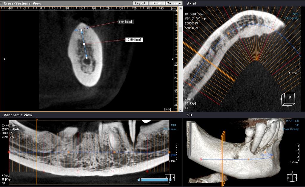 1. Computed Tomography 1-5.